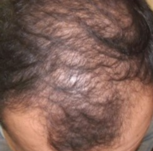 Before/After Image